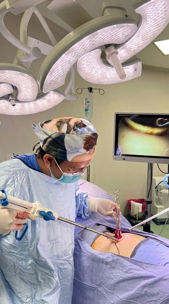 Cirugía laparoscópica de mínima invasión realizada por el Dr. Aldo Olvera Casas en Querétaro