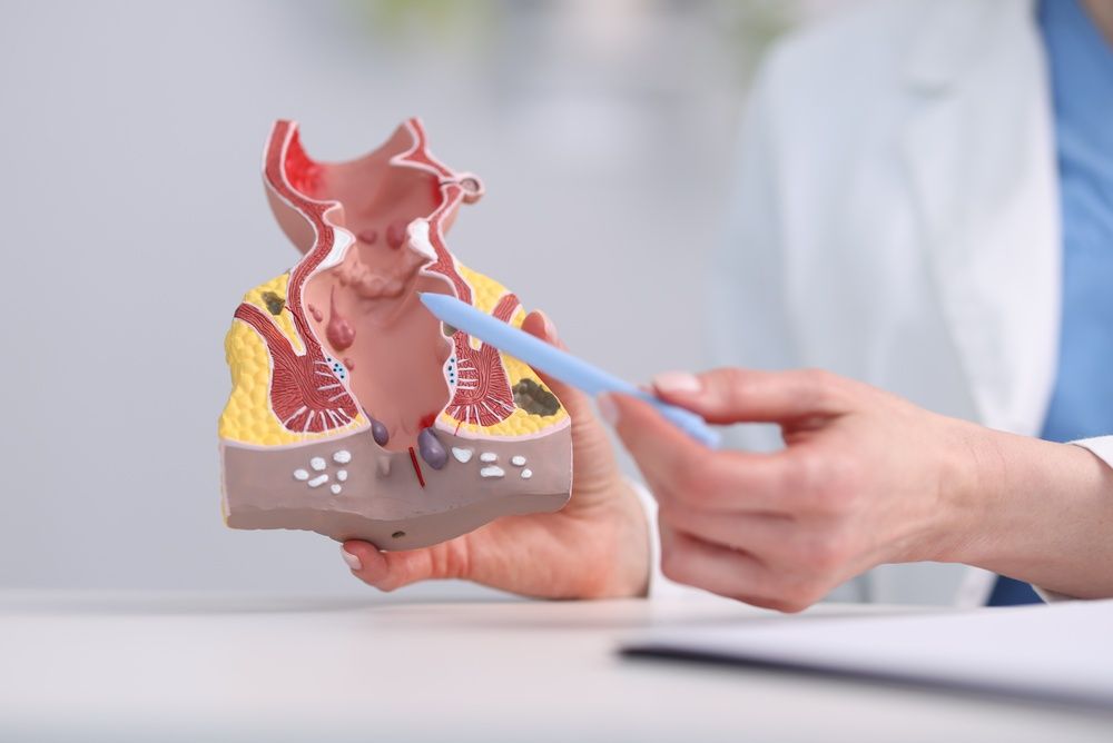 Cáncer de recto — Dr. Aldo Olvera Casas, Querétaro